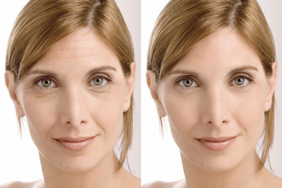 Usage experience before and after using Milana's intenskin cream
